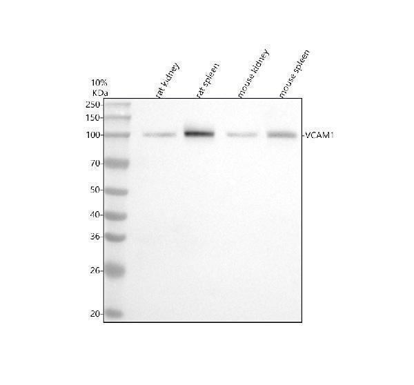  Western blot analysis of VCAM1/Cd106 using anti-VCAM1/Cd106 antibody (M01199-1)