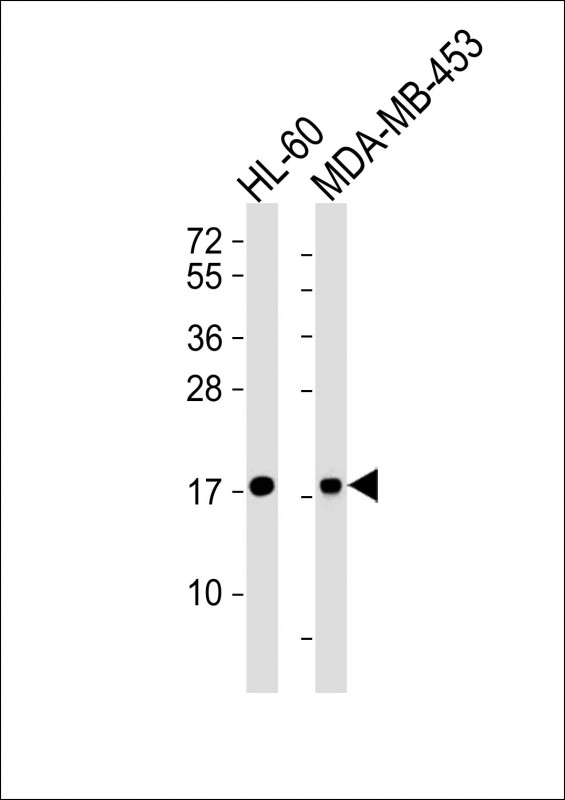 m01200 1 anti fhit antibody wb testing 1