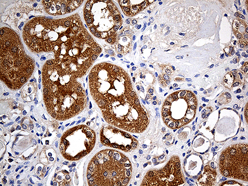 Immunohistochemical staining of paraffin-embedded Human Kidney tissue within the normal limits using anti-FHIT mouse monoclonal antibody