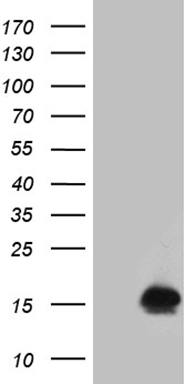 HEK293T cells were transfected with the pCMV6-ENTRY control (Left lane) or pCMV6-ENTRY FHIT (Right lane) cDNA for 48 hrs and lysed