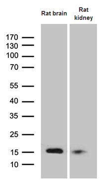 Western blot analysis of extracts (35ug) from 2 tissue lysates by using anti-FHIT monoclonal antibody (1:500)