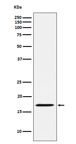 Western blot analysis of FHIT expression in Rat kidney lysate