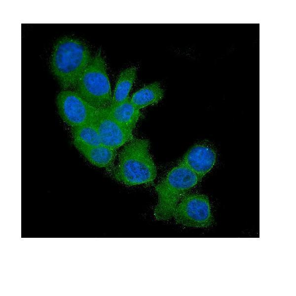  IF analysis of FHIT using anti-FHIT antibody (M01200)