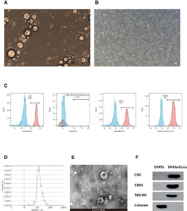 Illustrates the characterization of DFATs and exosomes