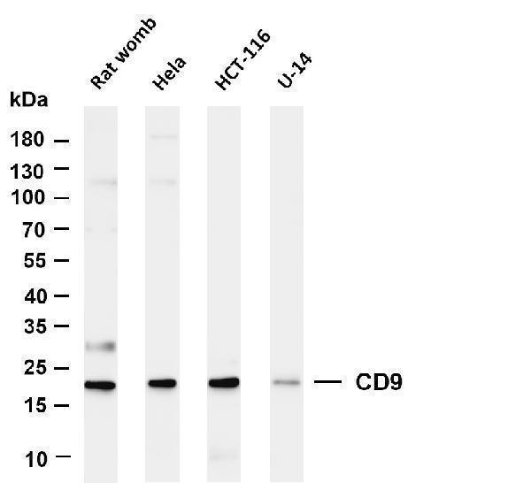 Various whole cell lysates were separated by 4-20% SDS-PAGE, and the membrane was blotted with anti-CD9 antibody