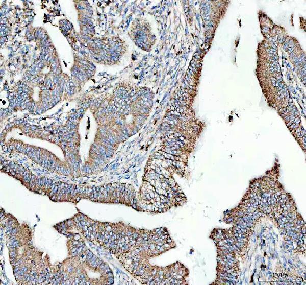 IHC analysis of CD9 using anti-CD9 antibody (M01202)