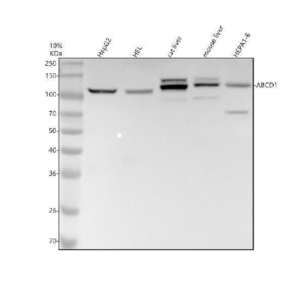 m01205 1 abcd1 primary antibodies wb testing 1