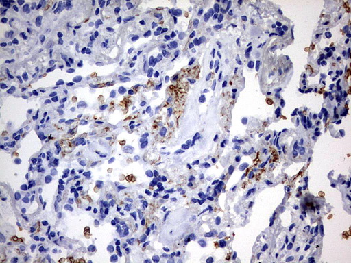 m01205 anti abcd1 mouse monoclonal antibody clone id oti2c12 ihc testing 2
