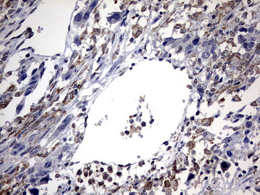 m01205 anti abcd1 mouse monoclonal antibody clone id oti2c12 ihc testing 3