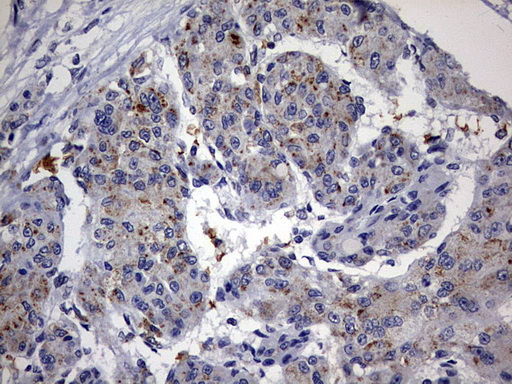 m01205 anti abcd1 mouse monoclonal antibody clone id oti2c12 ihc testing 4