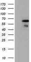 HEK293T cells were transfected with the pCMV6-ENTRY control (Left lane) or pCMV6-ENTRY NUMB (Right lane) cDNA for 48 hrs and lysed