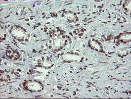 m01206 2 anti numb mouse monoclonal antibody clone id oti4f3 ihc testing 10
