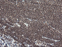 m01206 2 anti numb mouse monoclonal antibody clone id oti4f3 ihc testing 12