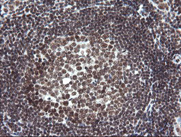 m01206 2 anti numb mouse monoclonal antibody clone id oti4f3 ihc testing 13