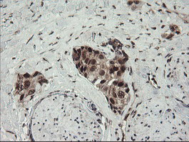 m01206 2 anti numb mouse monoclonal antibody clone id oti4f3 ihc testing 14