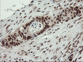 m01206 2 anti numb mouse monoclonal antibody clone id oti4f3 ihc testing 15