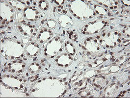 m01206 2 anti numb mouse monoclonal antibody clone id oti4f3 ihc testing 16