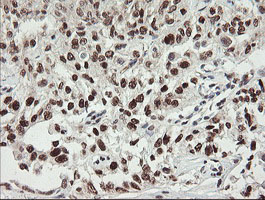 m01206 2 anti numb mouse monoclonal antibody clone id oti4f3 ihc testing 17