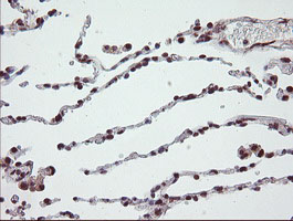 m01206 2 anti numb mouse monoclonal antibody clone id oti4f3 ihc testing 18