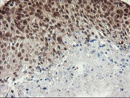 m01206 2 anti numb mouse monoclonal antibody clone id oti4f3 ihc testing 3