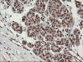 m01206 2 anti numb mouse monoclonal antibody clone id oti4f3 ihc testing 5