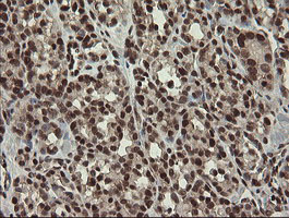 m01206 2 anti numb mouse monoclonal antibody clone id oti4f3 ihc testing 6