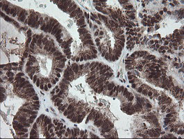 m01206 2 anti numb mouse monoclonal antibody clone id oti4f3 ihc testing 7