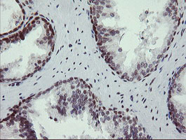 m01206 2 anti numb mouse monoclonal antibody clone id oti4f3 ihc testing 8