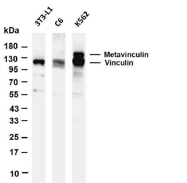Various whole cell lysates were separated by 4-20% SDS-PAGE, and the membrane was blotted with anti-Vinculin antibody