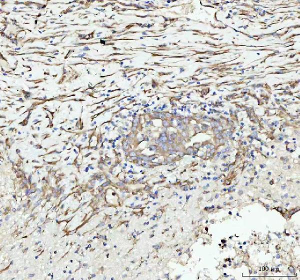 m01207 vinculin primary antibodies ihc testing 2
