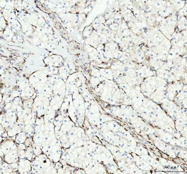m01207 vinculin primary antibodies ihc testing 3