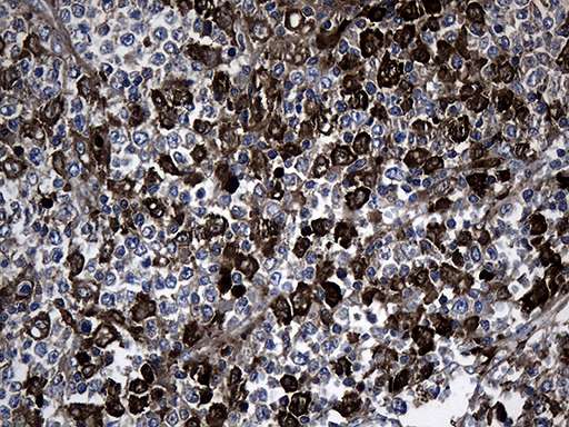 m01210 anti gtp cyclohydrolase 1 gch1 mouse monoclonal antibody clone id oti3a3 ihc testing 5