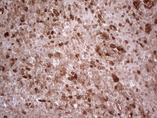 m01211 anti rhoc mouse monoclonal antibody clone id oti3a5 ihc testing 3