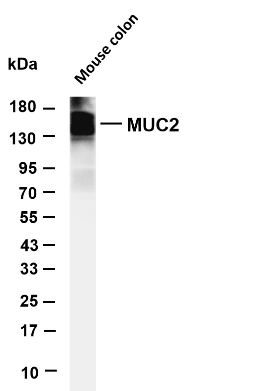 Various whole cell lysates were separated by 4-20% SDS-PAGE, and the membrane was blotted with anti-MUC2 antibody