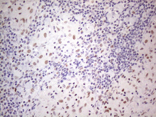m01215 anti thymine dna glycosylase tdg mouse monoclonal antibody clone id oti3c11 ihc testing 10