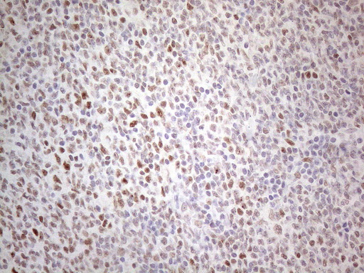m01215 anti thymine dna glycosylase tdg mouse monoclonal antibody clone id oti3c11 ihc testing 11