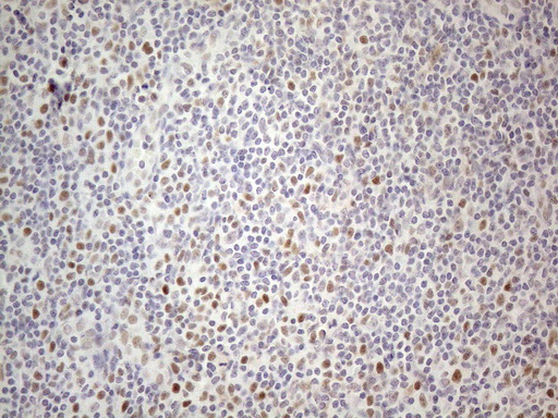 m01215 anti thymine dna glycosylase tdg mouse monoclonal antibody clone id oti3c11 ihc testing 12