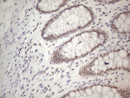 m01215 anti thymine dna glycosylase tdg mouse monoclonal antibody clone id oti3c11 ihc testing 13