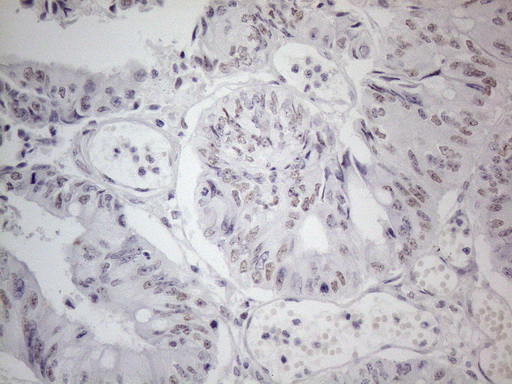 m01215 anti thymine dna glycosylase tdg mouse monoclonal antibody clone id oti3c11 ihc testing 14