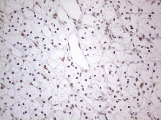 m01215 anti thymine dna glycosylase tdg mouse monoclonal antibody clone id oti3c11 ihc testing 15