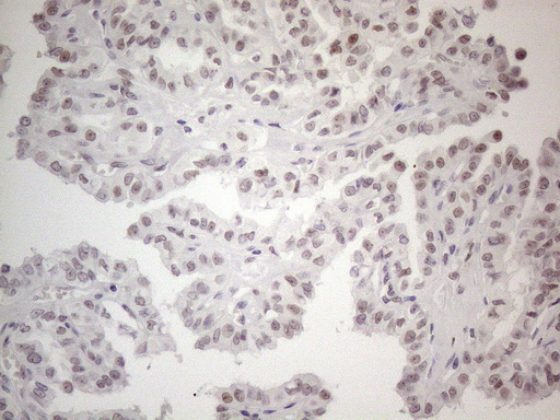 m01215 anti thymine dna glycosylase tdg mouse monoclonal antibody clone id oti3c11 ihc testing 5