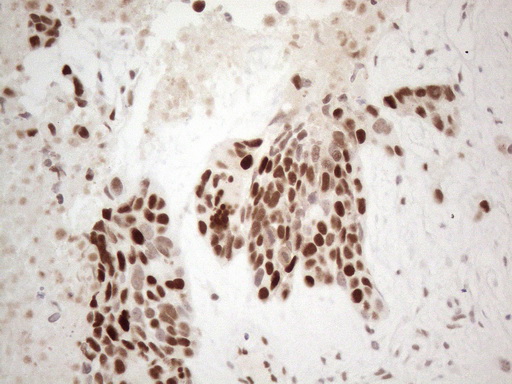 m01215 anti thymine dna glycosylase tdg mouse monoclonal antibody clone id oti3c11 ihc testing 6