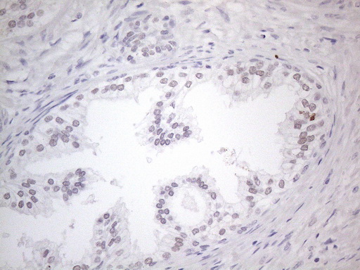 m01215 anti thymine dna glycosylase tdg mouse monoclonal antibody clone id oti3c11 ihc testing 7