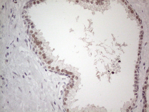 m01215 anti thymine dna glycosylase tdg mouse monoclonal antibody clone id oti3c11 ihc testing 8