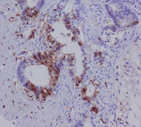 m01217 1 ihc