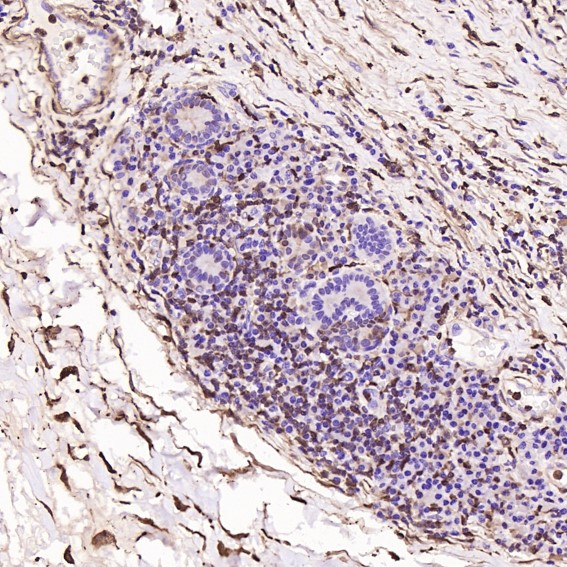 m01217 1 ihc10