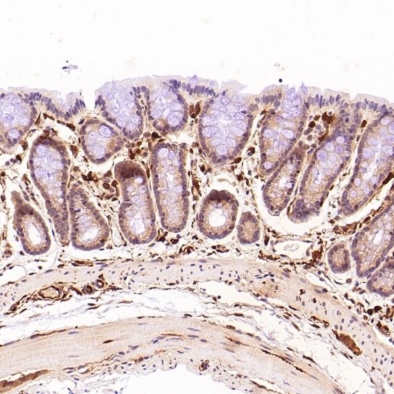 m01217 1 ihc7