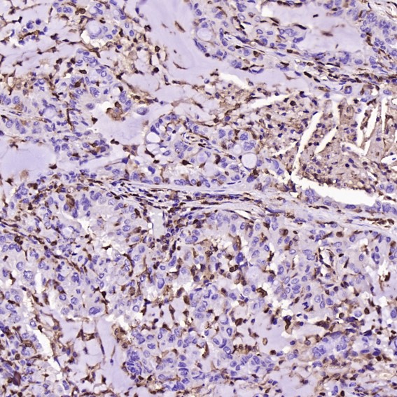 m01217 1 ihc8