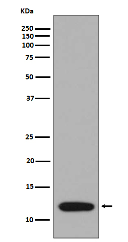 Western blot analysis of S100A4 expression in A375 cell lysate