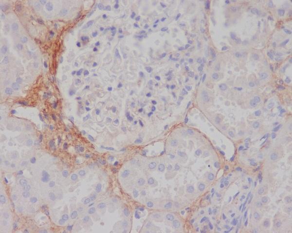 Immunohistochemical analysis of paraffin-embedded human kidney, using TGFBI Antibody